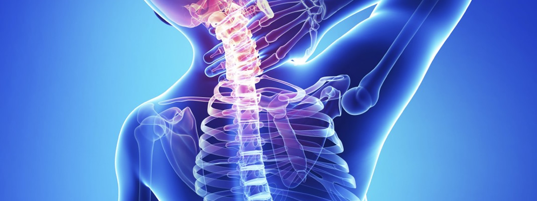 High Tetraplegia MAMEM